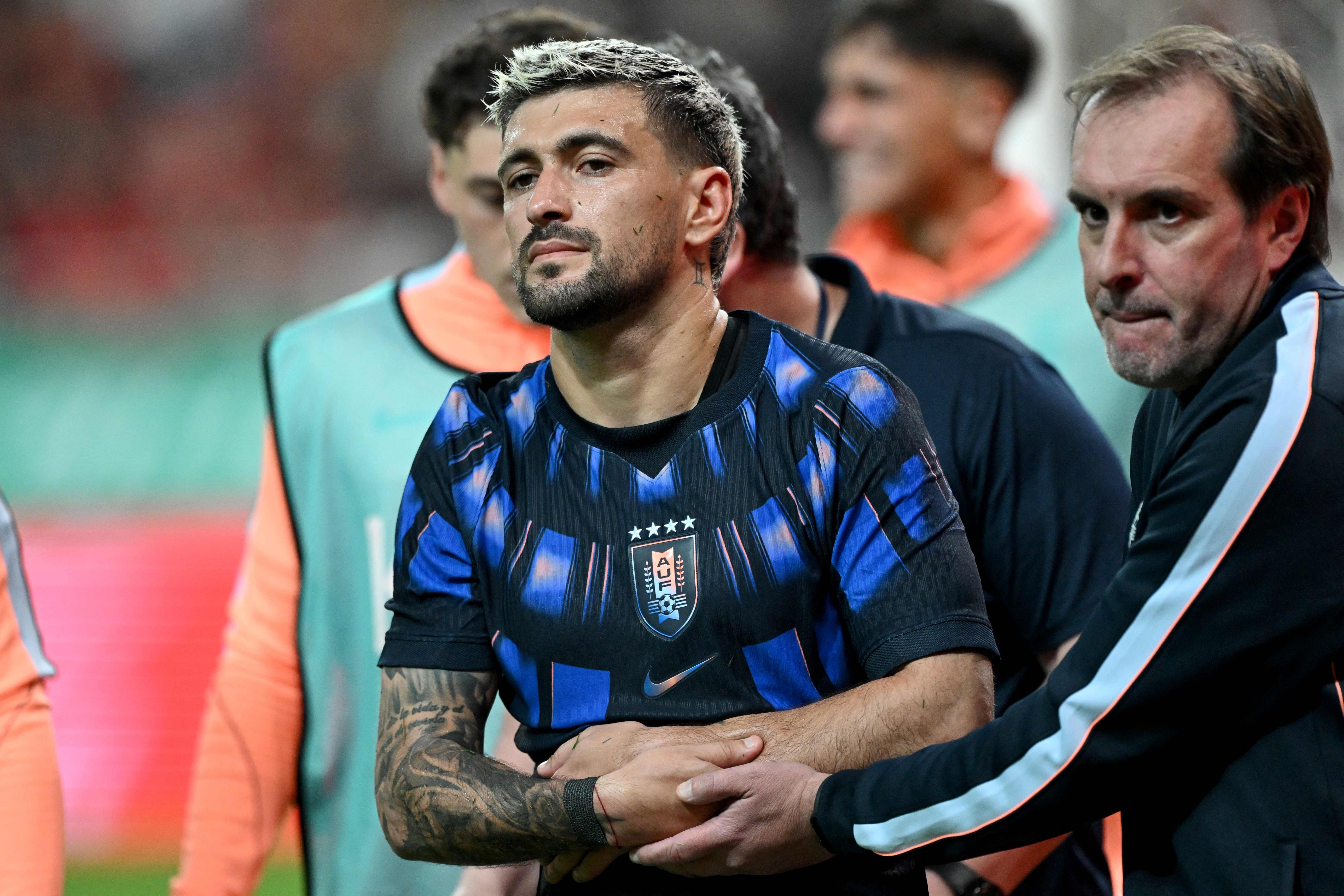Entenda por que Arrascaeta não pode jogar pelo Flamengo com proteção no punho fraturado