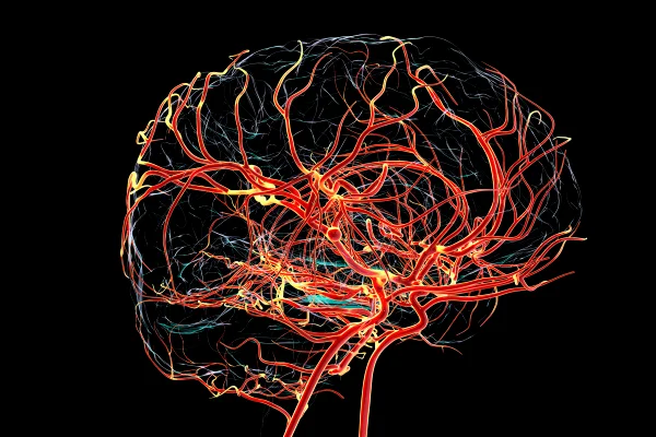 Alterações do Alzheimer podem surgir antes de falhas na memória, diz estudo