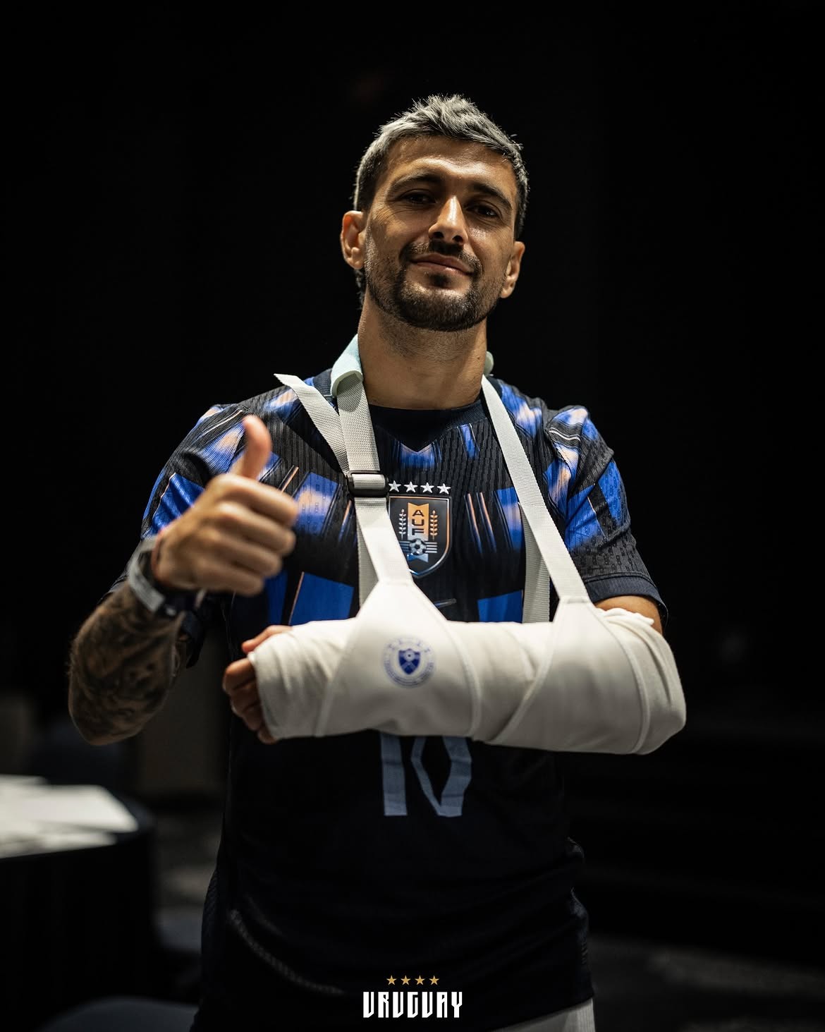 Flamengo: Entenda a cirurgia que Arrascaeta fará no punho esquerdo nesta quinta-feira