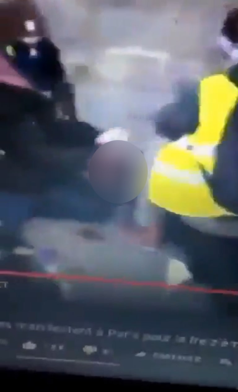 Adolescente perde a mão ao pegar granada atirada pela polícia durante protesto estudantil na França