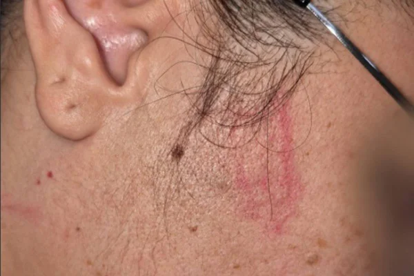 Fotos: técnica de enfermagem enforcada em UPA teve hematomas no pescoço - destaque galeria